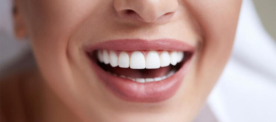 Sonra (beyazlamış)